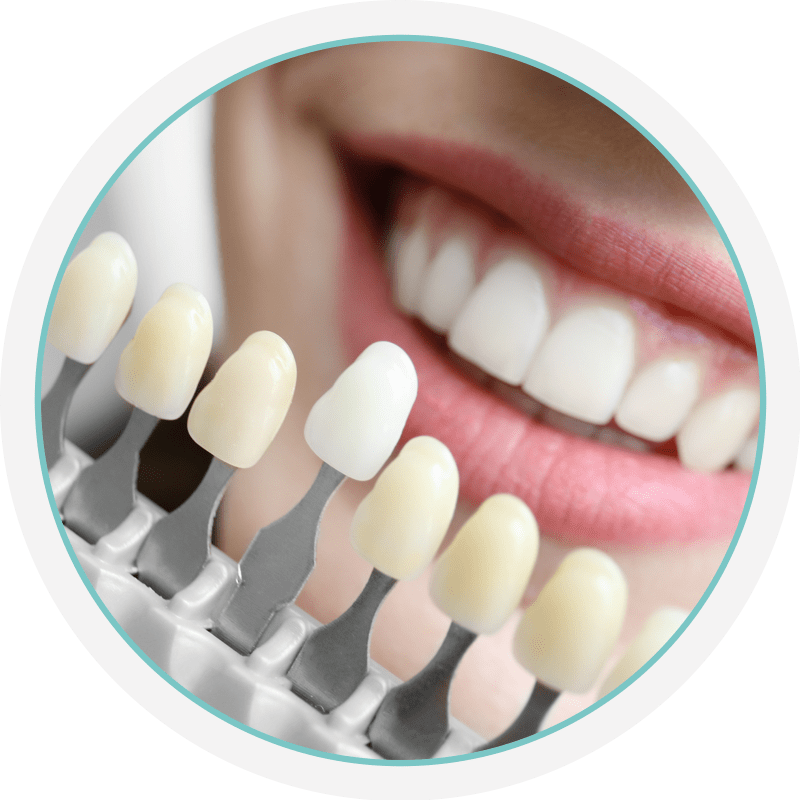 White teeth samples